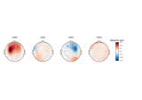 Motor imagery decoding from EEG data using the Common Spatial Pattern (CSP)