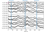 Visualise NIRS artifact correction methods