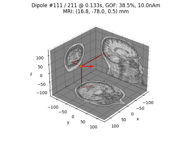 Dipole #111 / 211 @ 0.133s, GOF: 38.5%, 10.0nAm MRI: (16.8, -78.0, 0.5) mm