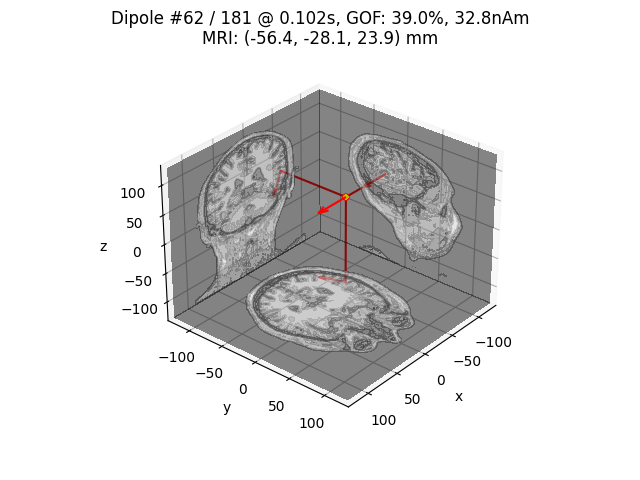Dipole #62 / 181 @ 0.102s, GOF: 39.0%, 32.8nAm MRI: (-56.4, -28.1, 23.9) mm