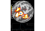 Morph surface source estimate