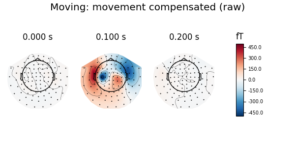Moving: movement compensated (raw), 0.000 s, 0.100 s, 0.200 s, fT
