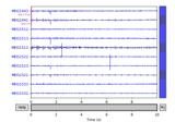 Plot sensor denoising using oversampled temporal projection