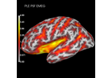 Compute spatial resolution metrics to compare MEG with EEG+MEG