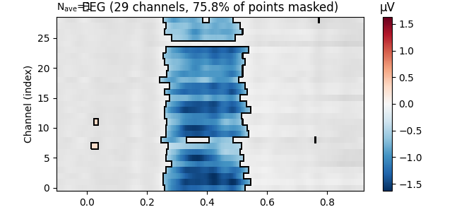 EEG (29 channels, 75.8% of points masked), µV