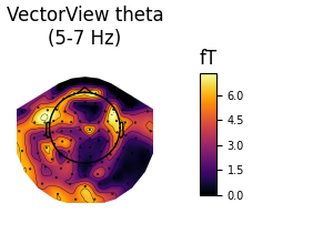 VectorView theta (5-7 Hz), fT