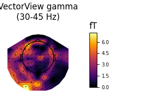 VectorView gamma (30-45 Hz), fT