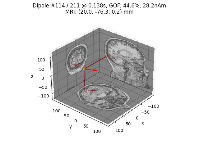 Dipole #114 / 211 @ 0.138s, GOF: 44.6%, 28.2nAm MRI: (20.0, -76.3, 0.2) mm