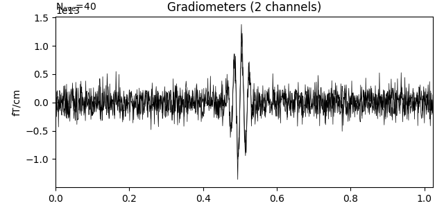 Gradiometers (2 channels)