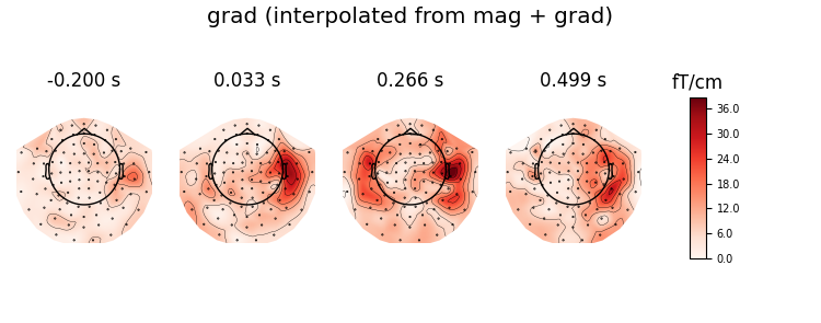 grad (interpolated from mag + grad), -0.200 s, 0.033 s, 0.266 s, 0.499 s, fT/cm