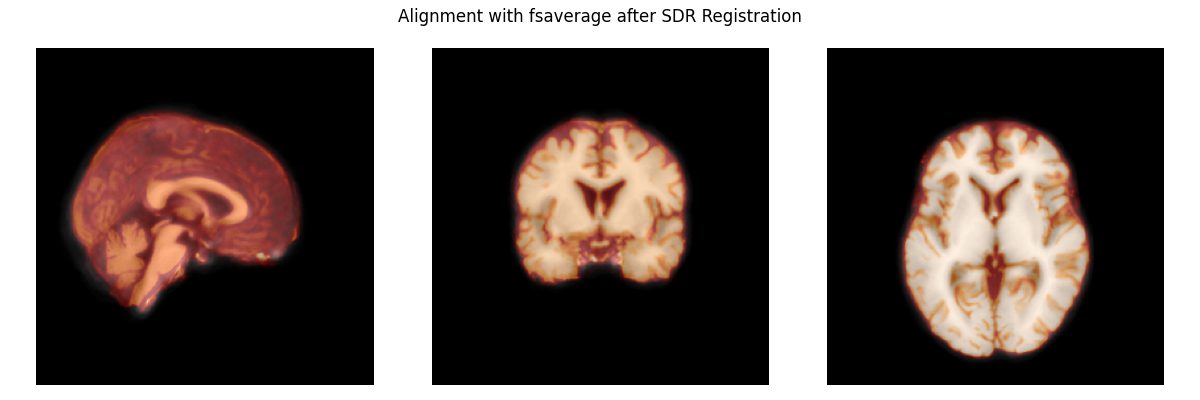 Alignment with fsaverage after SDR Registration