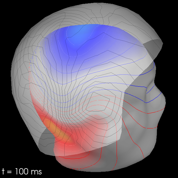 20 visualize evoked