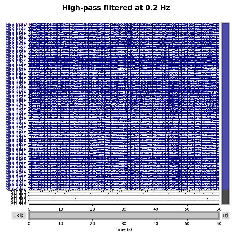 High-pass filtered at 0.2 Hz