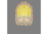 EEG forward operator with a template MRI