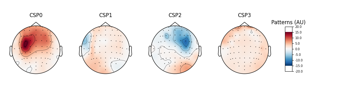 CSP0, CSP1, CSP2, CSP3, Patterns (AU)