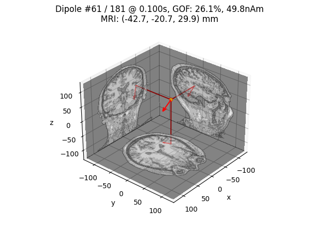 Dipole #61 / 181 @ 0.100s, GOF: 26.1%, 49.8nAm MRI: (-42.7, -20.7, 29.9) mm