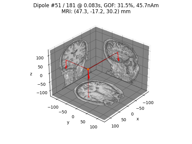 Dipole #51 / 181 @ 0.083s, GOF: 31.5%, 45.7nAm MRI: (47.3, -17.2, 30.2) mm