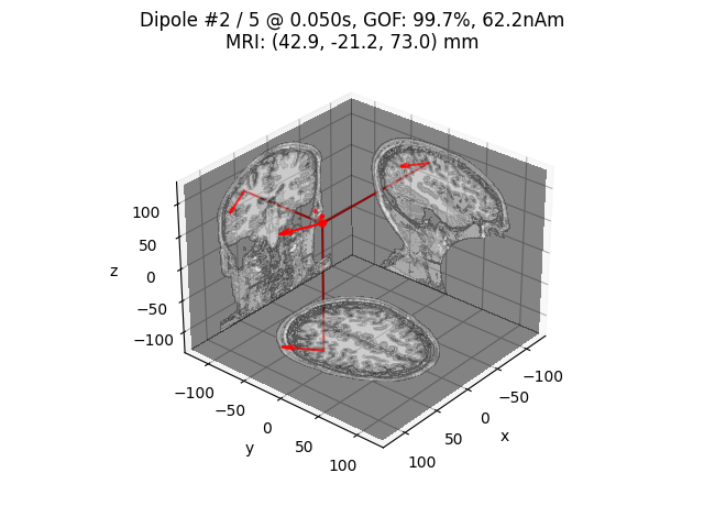 Dipole #2 / 5 @ 0.050s, GOF: 99.7%, 62.2nAm MRI: (42.9, -21.2, 73.0) mm