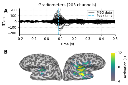 Gradiometers (203 channels)