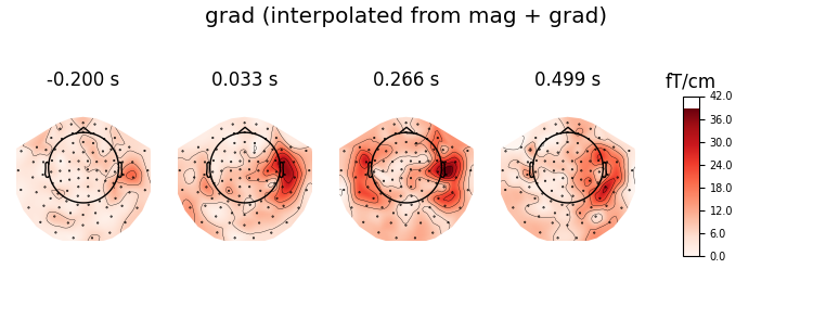 grad (interpolated from mag + grad), -0.200 s, 0.033 s, 0.266 s, 0.499 s, fT/cm