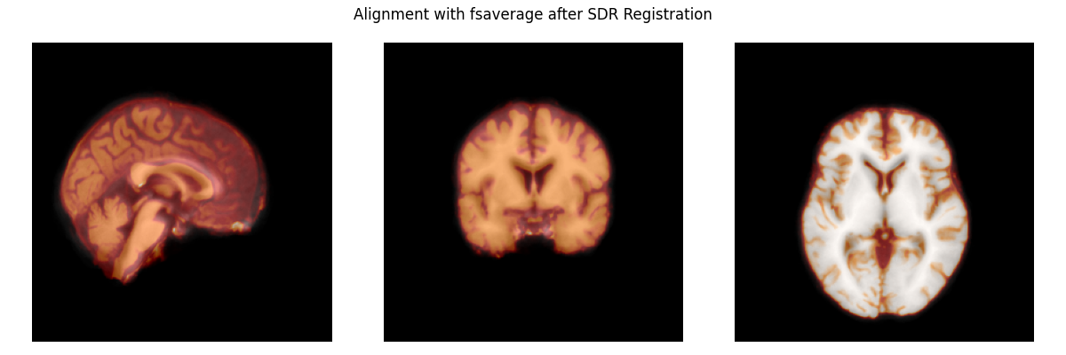Alignment with fsaverage after SDR Registration