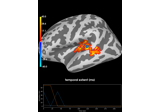 Permutation t-test on source data with spatio-temporal clustering