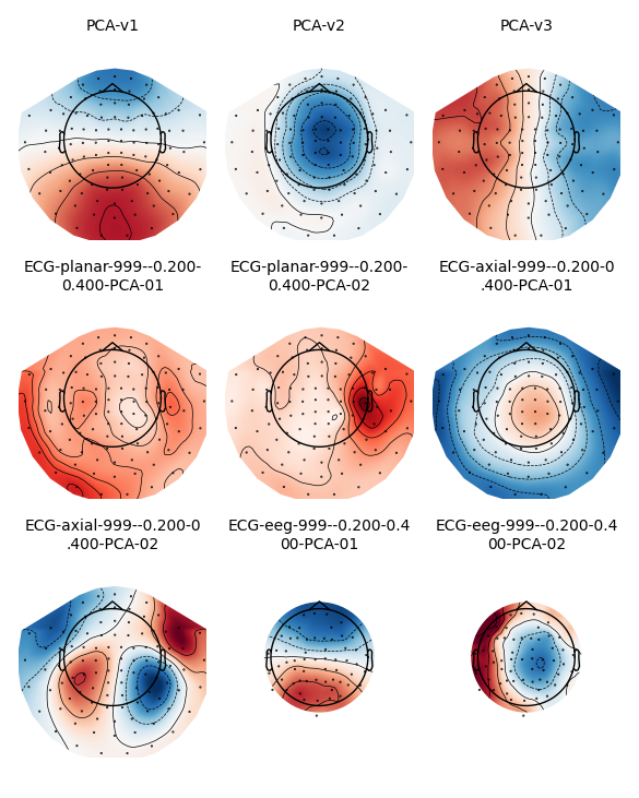 PCA-v1, PCA-v2, PCA-v3, ECG-planar-999--0.200- 0.400-PCA-01, ECG-planar-999--0.200- 0.400-PCA-02, ECG-axial-999--0.200-0 .400-PCA-01, ECG-axial-999--0.200-0 .400-PCA-02, ECG-eeg-999--0.200-0.4 00-PCA-01, ECG-eeg-999--0.200-0.4 00-PCA-02