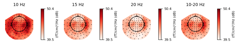 10 Hz, 15 Hz, 20 Hz, 10-20 Hz