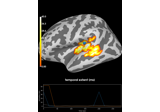 2 samples permutation test on source data with spatio-temporal clustering