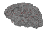 The role of dipole orientations in distributed source localization