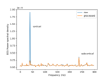 Cortical Signal Suppression (CSS) for removal of cortical signals