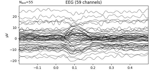 EEG (59 channels)