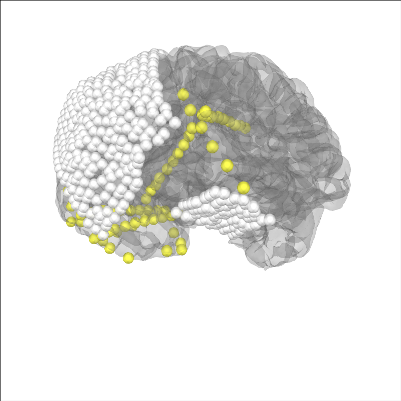 10 ieeg localize