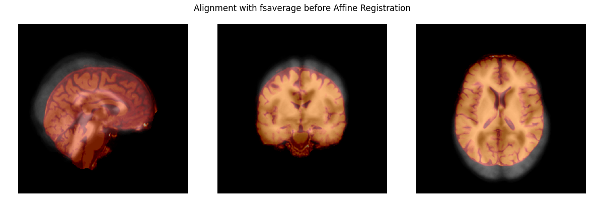 Alignment with fsaverage before Affine Registration