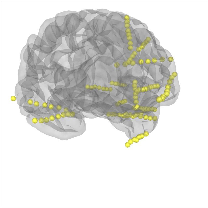 10 ieeg localize