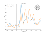 Overview of MEG/EEG analysis with MNE-Python