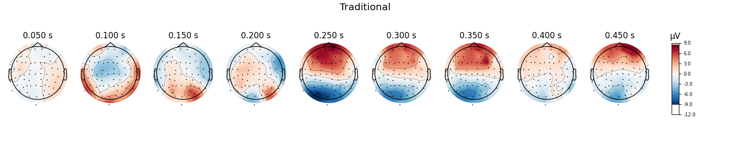 Traditional, 0.050 s, 0.100 s, 0.150 s, 0.200 s, 0.250 s, 0.300 s, 0.350 s, 0.400 s, 0.450 s, µV