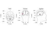 Source localization with equivalent current dipole (ECD) fit