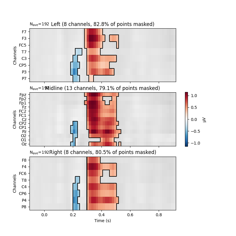 Left (8 channels, 82.8% of points masked), Midline (13 channels, 79.1% of points masked), Right (8 channels, 80.5% of points masked)