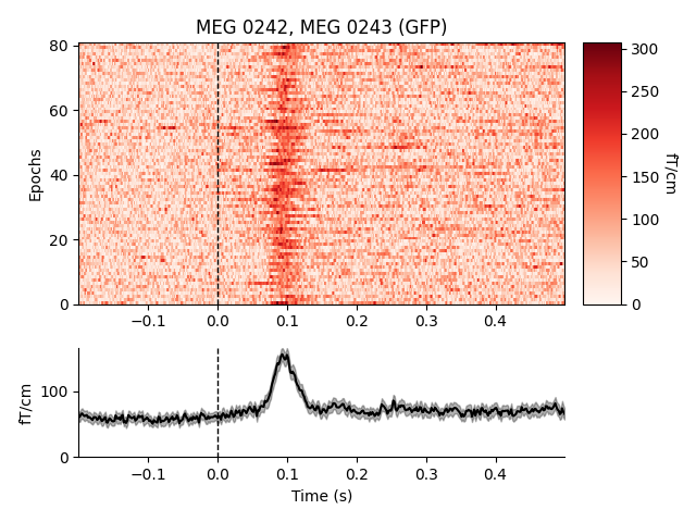 MEG 0242, MEG 0243 (GFP)