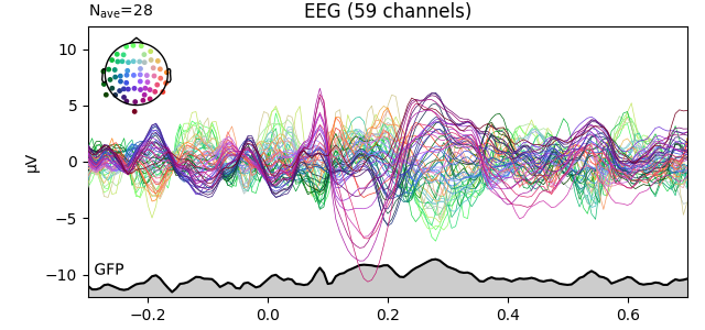 EEG (59 channels)