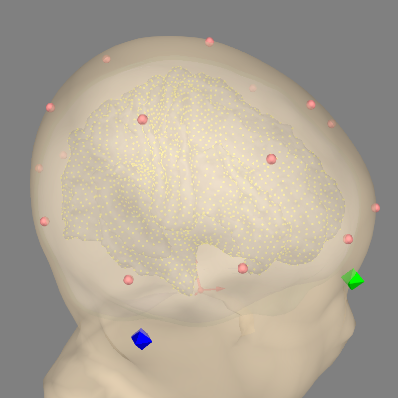 35 eeg no mri