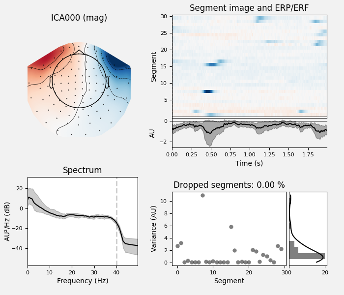 ICA000 (mag), Segment image and ERP/ERF, Spectrum, Dropped segments: 0.00 %