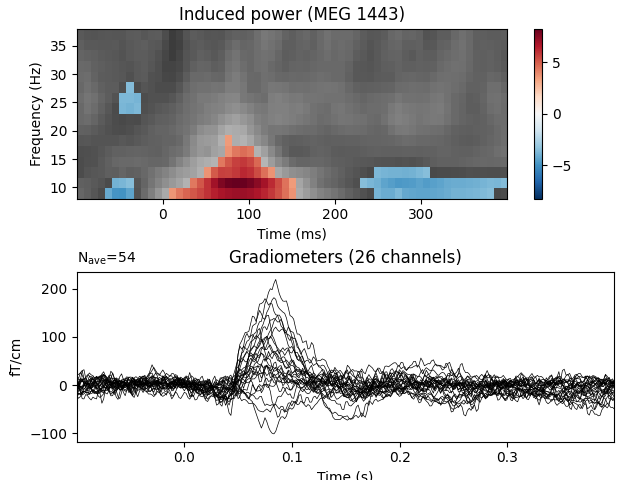 Induced power (MEG 1443), Gradiometers (26 channels)