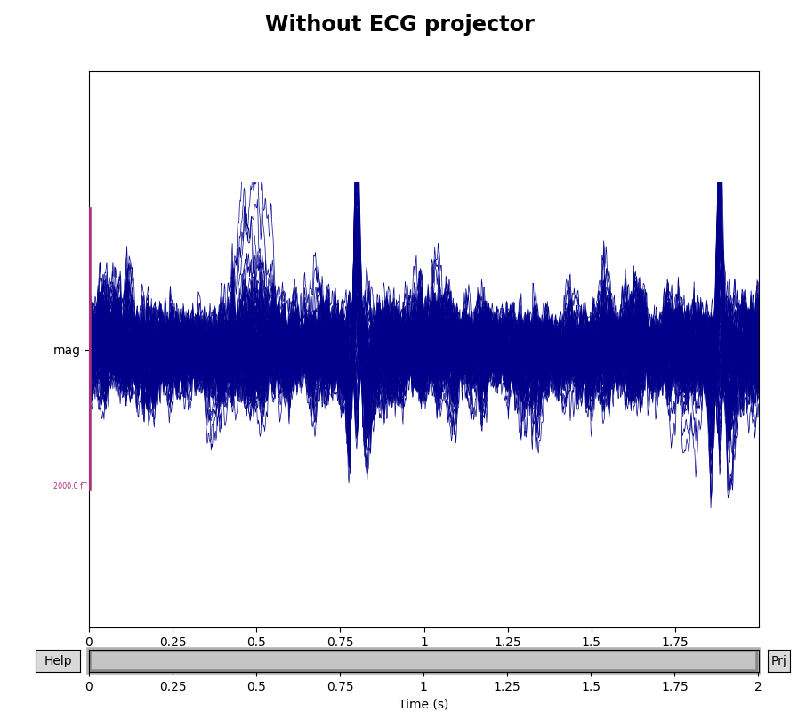 Without ECG projector