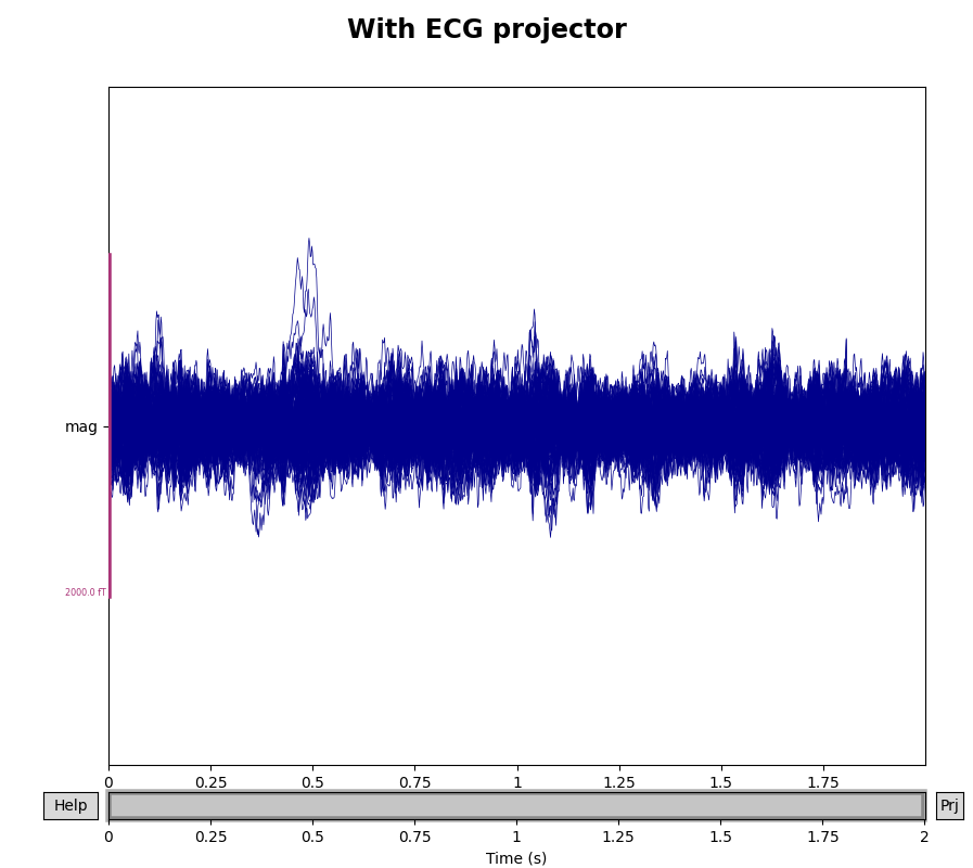 With ECG projector