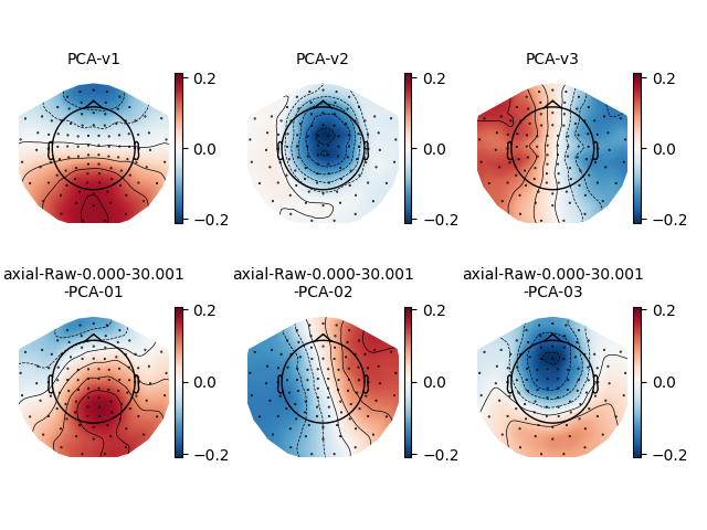 PCA-v1, PCA-v2, PCA-v3, axial-Raw-0.000-30.001 -PCA-01, axial-Raw-0.000-30.001 -PCA-02, axial-Raw-0.000-30.001 -PCA-03