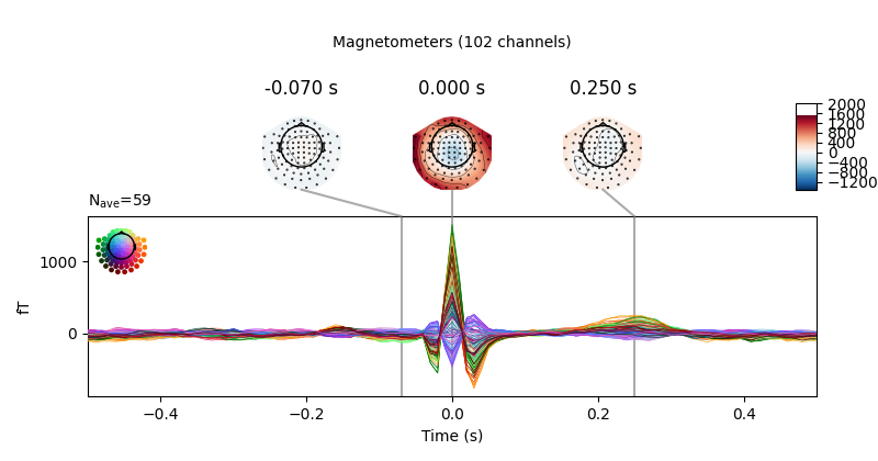 -0.070 s, 0.000 s, 0.250 s