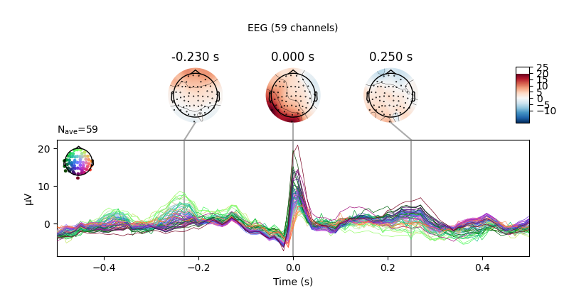 -0.230 s, 0.000 s, 0.250 s