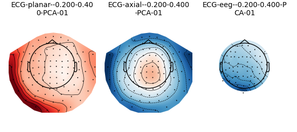 ECG-planar--0.200-0.40 0-PCA-01, ECG-axial--0.200-0.400 -PCA-01, ECG-eeg--0.200-0.400-P CA-01